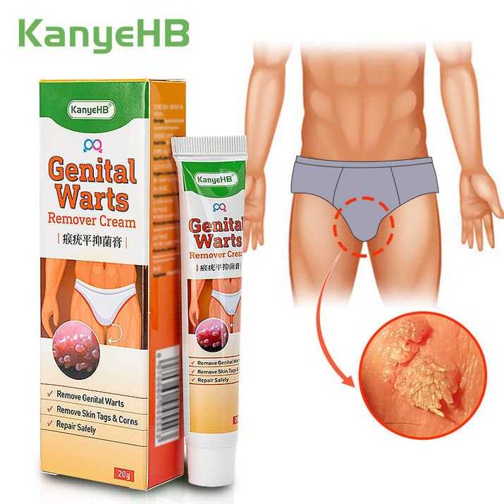 Pinghouyou Wart Remover Cream