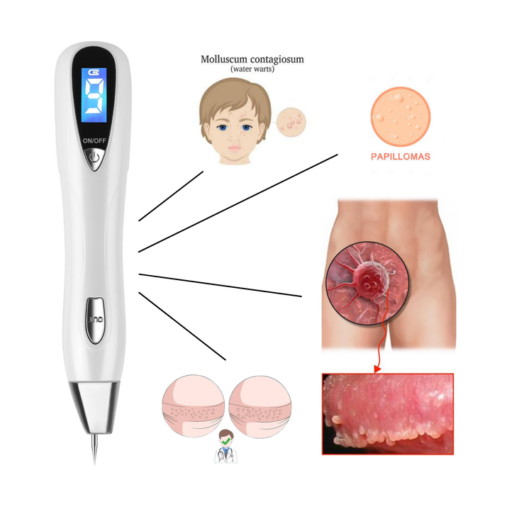 1Pc Skin Tag Remover Skin Tag Repair Kit Tattoo Freckle Wart Mole Remover Pen With 9 Intensity Levels 10 Fine Needles 3 Coarse Needles